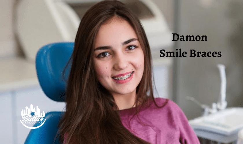 Damon smile Braces