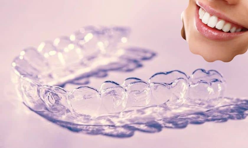 Benefits Of Getting Invisalign From Top Orthodontists