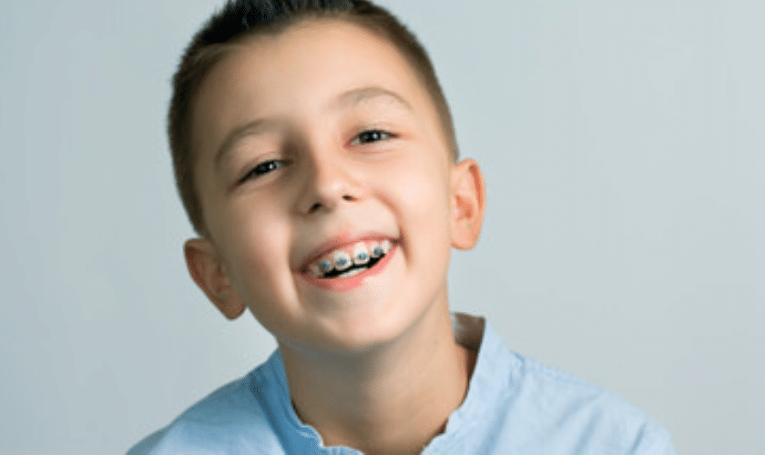 How To Choose Right Braces For Kids?